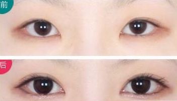 全國頂級整形醫(yī)院奉上前十年度最佳隆胸選擇！專業(yè)可靠服務(wù)，平價優(yōu)惠！