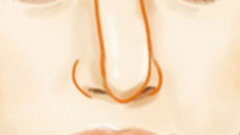 南京私密整形——關(guān)于這個你或許不知道的小秘密 南京私密整形——關(guān)于這個你或許不知道的小秘密