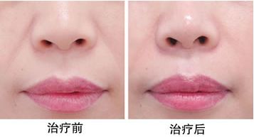 最靠譜的蘇州下頜角整形醫(yī)院推薦，口碑爆棚的醫(yī)療機(jī)構(gòu)評(píng)選