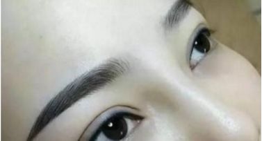 北京哪個(gè)醫(yī)院治療胎記效果好？這家醫(yī)院備受推崇
