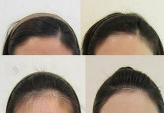 上海久愿整形醫(yī)院:醫(yī)術(shù)高超的專家團(tuán)隊(duì)及服務(wù)費(fèi)用展示 上海久愿整形醫(yī)院:醫(yī)術(shù)高超的專家團(tuán)隊(duì)及服務(wù)費(fèi)用展示