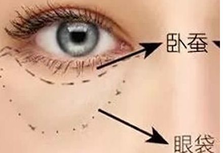 北京協(xié)和醫(yī)院隆胸案例與醫(yī)生簡介含金量如何？收費(fèi)是否合理？