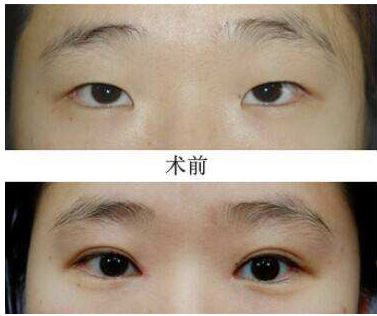 成都比較好的雙眼皮整形醫(yī)院推薦 七家熱門整容醫(yī)院名單展示 成都比較好的雙眼皮整形醫(yī)院推薦 七家熱門整容醫(yī)院名單展示