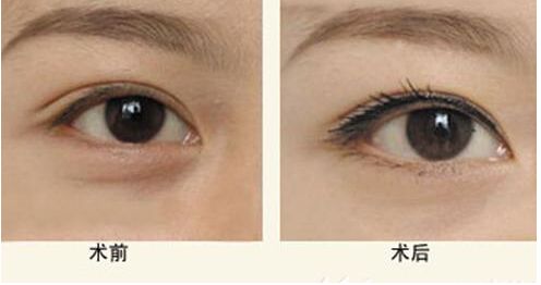 【獨(dú)家】上海九院整形科醫(yī)生王琛醫(yī)生的專長與案例分享 【獨(dú)家】上海九院整形科醫(yī)生王琛醫(yī)生的專長與案例分享