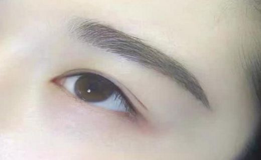 哈爾濱滕雙艷雙眼皮手術(shù)技術(shù)及成功案例全解析 哈爾濱滕雙艷雙眼皮手術(shù)技術(shù)及成功案例全解析