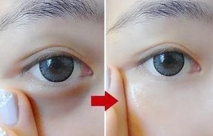 鄭州恩喜整形醫(yī)院:持續(xù)80天逐漸呈現(xiàn)完美隆鼻效果的揭秘 鄭州恩喜整形醫(yī)院:持續(xù)80天逐漸呈現(xiàn)完美隆鼻效果的揭秘