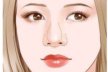 濟南哪家醫(yī)生做雙眼皮效果好？謝燕燕醫(yī)生實力及案例揭秘！