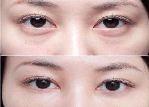 杭州專業(yè)整容醫(yī)療機構(gòu)排行榜大揭秘！藝術(shù)之星醫(yī)療集團對比時光整形大賽！真實原因還原無遺！