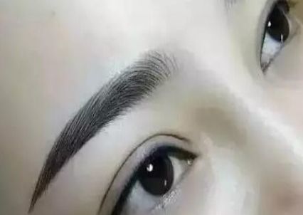 選擇最適合您的雙眼皮手術(shù)醫(yī)院-專業(yè)的推薦 選擇最適合您的雙眼皮手術(shù)醫(yī)院-專業(yè)的推薦