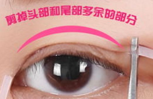 樂山市人民醫(yī)院眼袋手術(shù)口碑如何？醫(yī)生推薦+真實(shí)案例分析