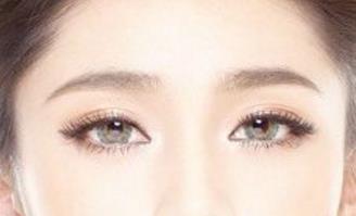 石家莊美聯(lián)臣雙眼皮整形靠譜嗎？有哪些優(yōu)秀醫(yī)生？有什么成功案例供參考？