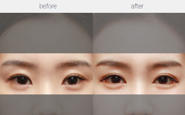 【特約】重慶鼻整形手術修復醫(yī)生五強名單揭曉，專家推薦！