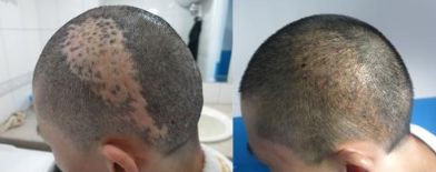 杭州有哪些專業(yè)技術(shù)過硬的鼻修復(fù)醫(yī)院？推薦浙江第二醫(yī)院、薇琳整形醫(yī)院、清鍇醫(yī)療美容中心等