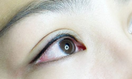 劉中國(guó)醫(yī)生成都潤(rùn)美玉之光整形醫(yī)院的口碑是否好？大腿吸脂術(shù)效果如何呢？