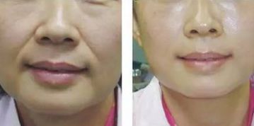 青島鼻修復(fù)：頂級專家實力享譽！唇齒相依的實力推薦