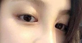 如何選擇合適的醫(yī)生，讓你的身材變得完美無(wú)暇