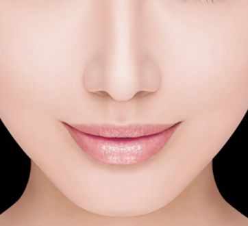 哈醫(yī)大四院李巍主治醫(yī)生鼻整形手術！80天重塑完美鼻型全記錄！