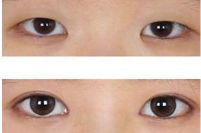 選擇合適的武漢植發(fā)醫(yī)院，看看專家排名和推薦