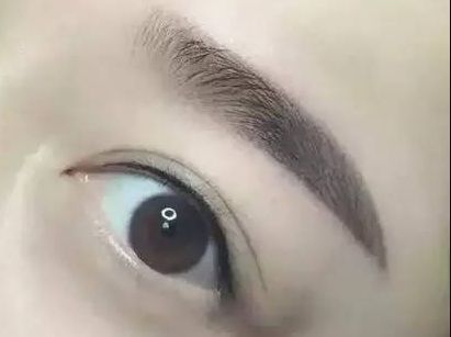 護(hù)眼實踐：林琦東如何改善視力？真實案例揭示眼部整形費用