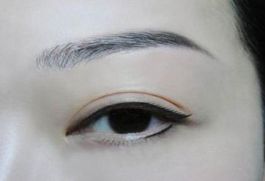 深圳著名眼袋整形專家?guī)湍獯?，鵬程醫(yī)院是否值得選擇？