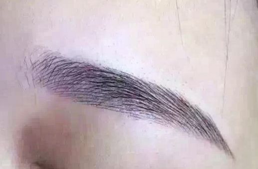長沙脂肪吸取專家揭秘：技術卓越，無數(shù)口碑背后的醫(yī)美奇跡！