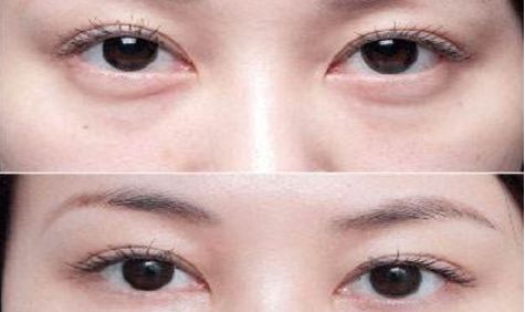 成都眼部整形醫(yī)生高分榜單發(fā)布！這些醫(yī)生哪家強(qiáng)？附詳細(xì)醫(yī)生信息