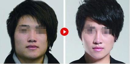 廣州美萊田躍平醫(yī)生為您帶來的鼻部整形體驗案例曝光 廣州美萊田躍平醫(yī)生為您帶來的鼻部整形體驗案例曝光