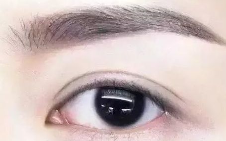 全國(guó)哪位專家值得信賴修復(fù)雙眼皮手術(shù)？頂級(jí)醫(yī)生排行榜首推名單揭曉