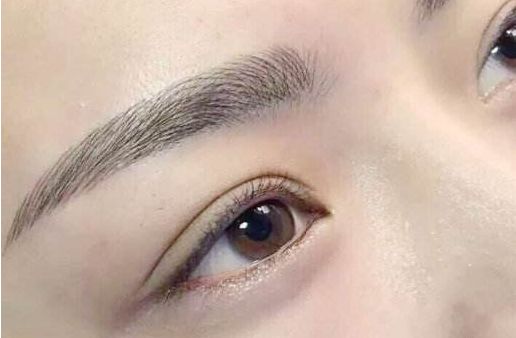 眼袋手術(shù)費(fèi)用及醫(yī)生評價(jià)與項(xiàng)目分析？