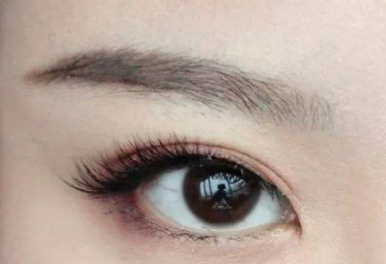 大連王琳雙眼皮的完美實踐，80天親身體驗揭秘