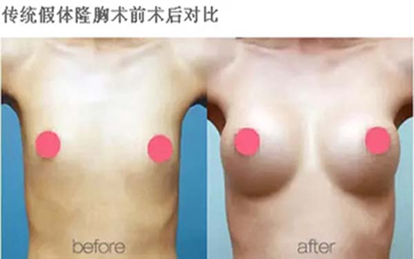 首選，你想知道成都素美脂肪填充的表現(xiàn)如何？！其次，成都素美脂肪填充的效果如何呢？