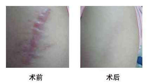 濟(jì)南有哪些人氣更高的美容整形醫(yī)院海峽和旭美如何評價 濟(jì)南有哪些人氣更高的美容整形醫(yī)院海峽和旭美如何評價
