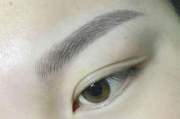 國內(nèi)公開的疤痕修復(fù)中心盤點(diǎn)，醫(yī)療美容聲譽(yù)不凡值得借鑒