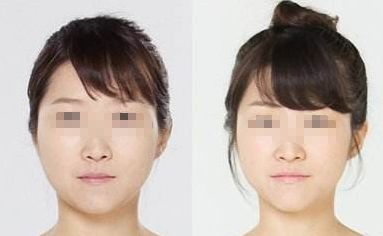 廣州哪家醫(yī)院能夠有效除皺？詳細介紹醫(yī)院基本情況分享