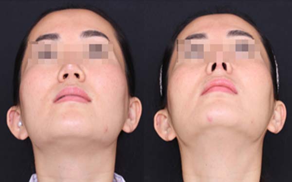 淄博麗人醫(yī)院整形美容科靠譜嗎？有口碑醫(yī)生推薦嗎？