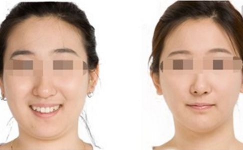 鄭州哪位醫(yī)生在鼻整形領域赫赫有名？口碑出類拔萃的五位專家揭曉！