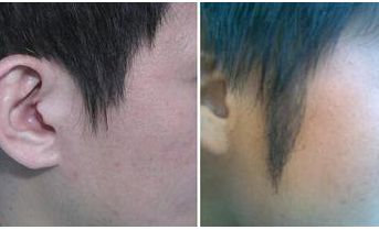 西安著名拉皮手術(shù)醫(yī)生推薦！專家團隊不俗技藝，魯禮新、楊萬忠亮相
