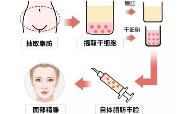 從醫(yī)生個(gè)人資料到豐胸案例圖對(duì)比，揭秘王沛森的豐胸效果！