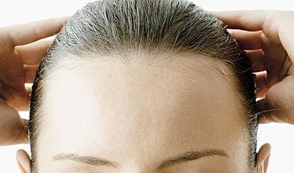 郭建玲雙眼皮修復(fù)費(fèi)用揭秘！看真實(shí)案例圖分享，了解其技術(shù)效果！
