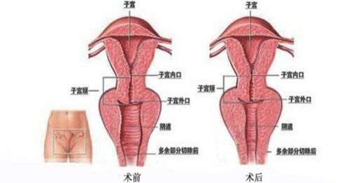 上海九院哪里能夠得到專業(yè)的隆鼻手術(shù)？排行榜最新推薦五位頂尖隆鼻專家
