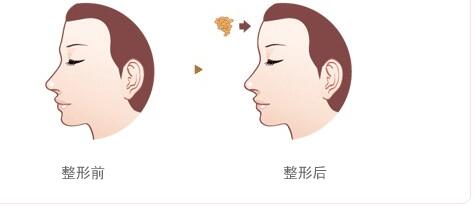 綿陽碧蓮盛植發(fā)醫(yī)院的效果如何？如何查詢地址及醫(yī)生信息？