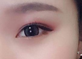蔣小花醫(yī)生手術(shù)的實際操作方法和評價分享，多樣風格消解揭秘！