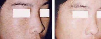 福州美貝爾醫(yī)療美容門診部：薛欣醫(yī)生用戶評(píng)價(jià)高？真實(shí)案例分享！