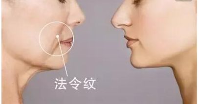 韋元強(qiáng)swan吸脂修復(fù)方法介紹，相關(guān)醫(yī)院推薦