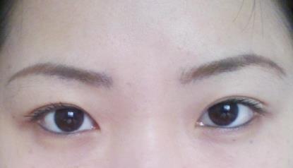 北京明會紅醫(yī)療美容診所價格表真實嗎？你會不會覺得有點匪夷所思？