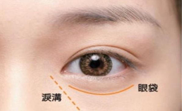 深圳哪家醫(yī)院割雙眼皮技術(shù)獨步全球？高水平專家團隊助力