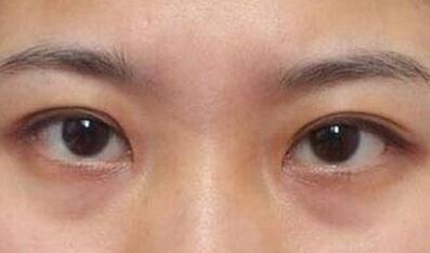 杭州東方整形吸脂到底值不值得嘗試？
