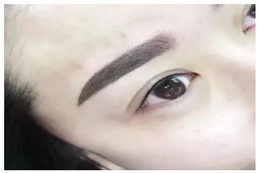 無錫伊爾美整形醫(yī)院丨2023最火隆胸案例分享 無錫伊爾美整形醫(yī)院丨2023最火隆胸案例分享
