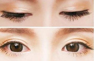 青島壹美天成整形醫(yī)院的隆鼻技術(shù)如何？看看這些真實案例！