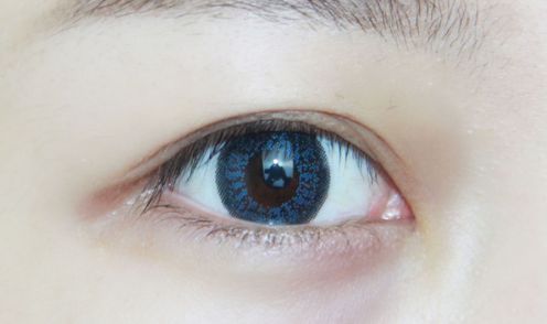 杭州超美抗皺醫(yī)院盤點(diǎn):歐洲之星煥發(fā)年輕態(tài) 杭州超美抗皺醫(yī)院盤點(diǎn):歐洲之星煥發(fā)年輕態(tài)